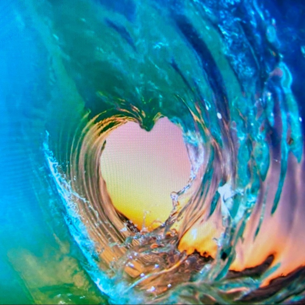 OPEN HEART